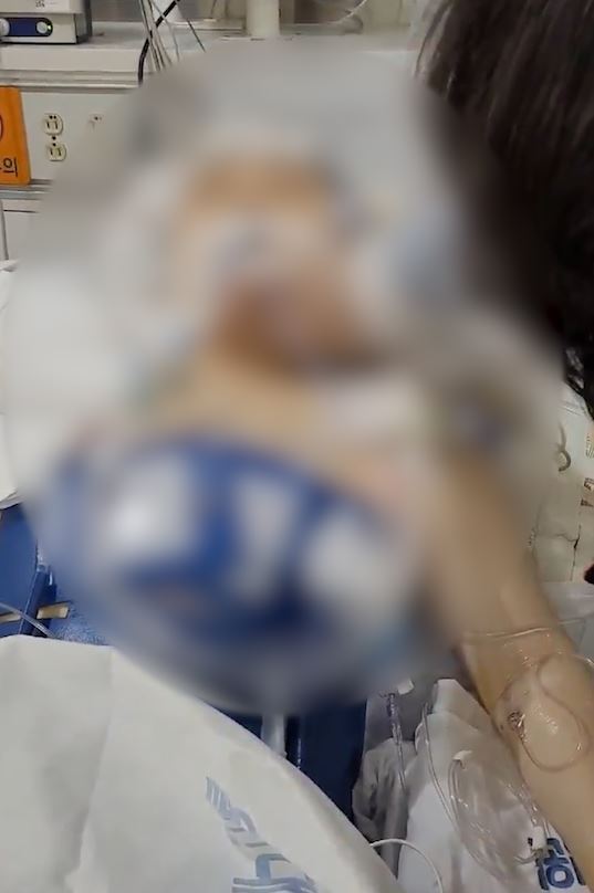 의식불명 상태로 중환자실에 있는 피해자(가족제공)